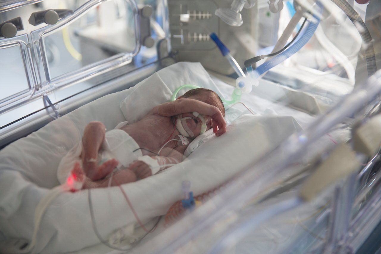 Premature newborn lying in an incubator in a neonatal intensive care unit, connected to various life-support and monitoring devices.