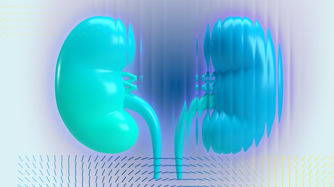 CKD Nutrition Webinar 2026, Preview Image