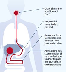 SiderAL 