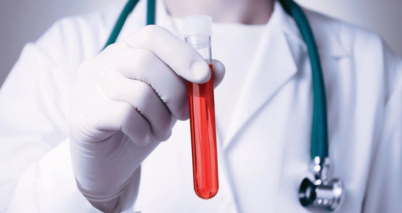 Doctor holding vial