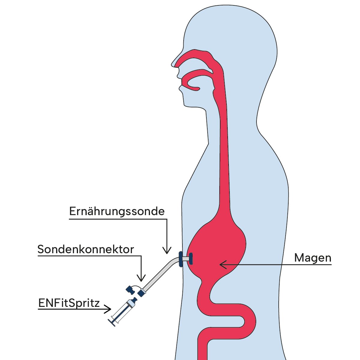 InfografikApplikationswege_Bolusabgabe