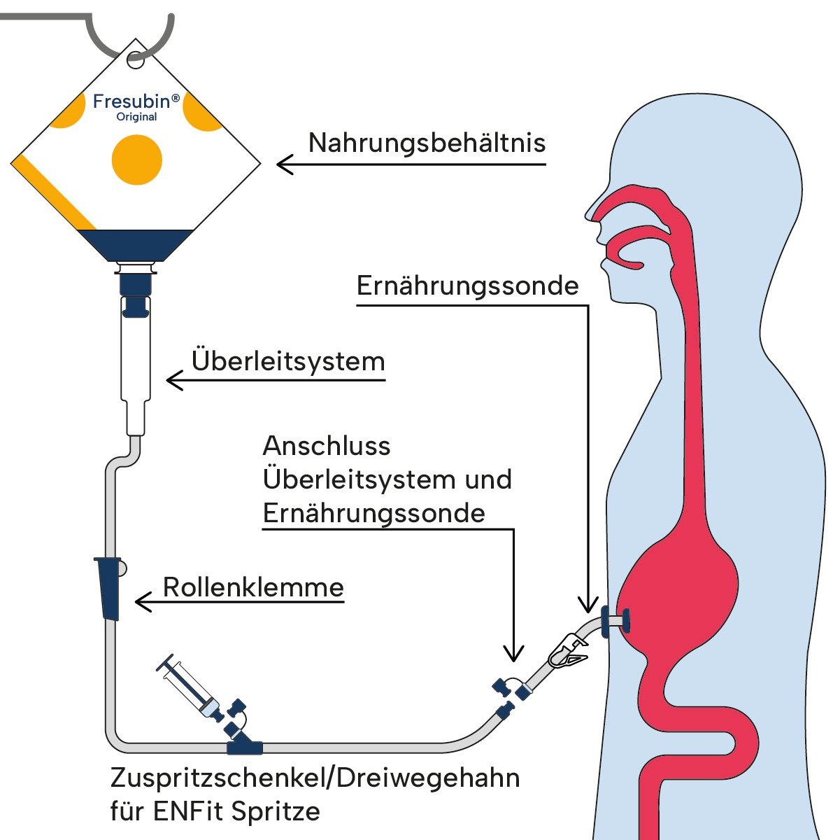 InfografikApplikationswege_Bolusabgabe