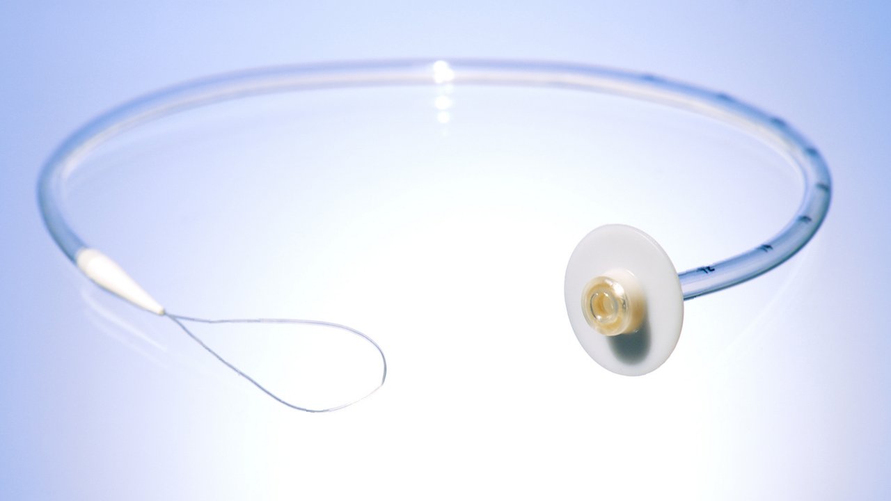 freka-peg-gastric-feeding-tube