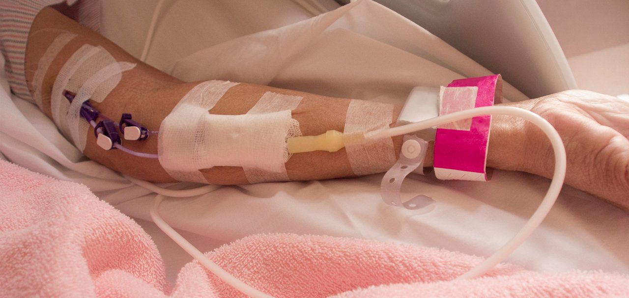 A close-up view of an arm with intravenous access tubing secured using medical tape and bandages.