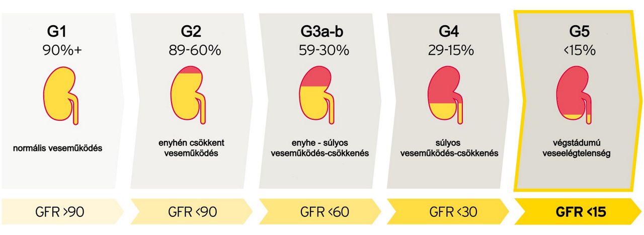 A krónikus vesebetegség stádiumai és a hozzájuk tartozó GFR-értékek