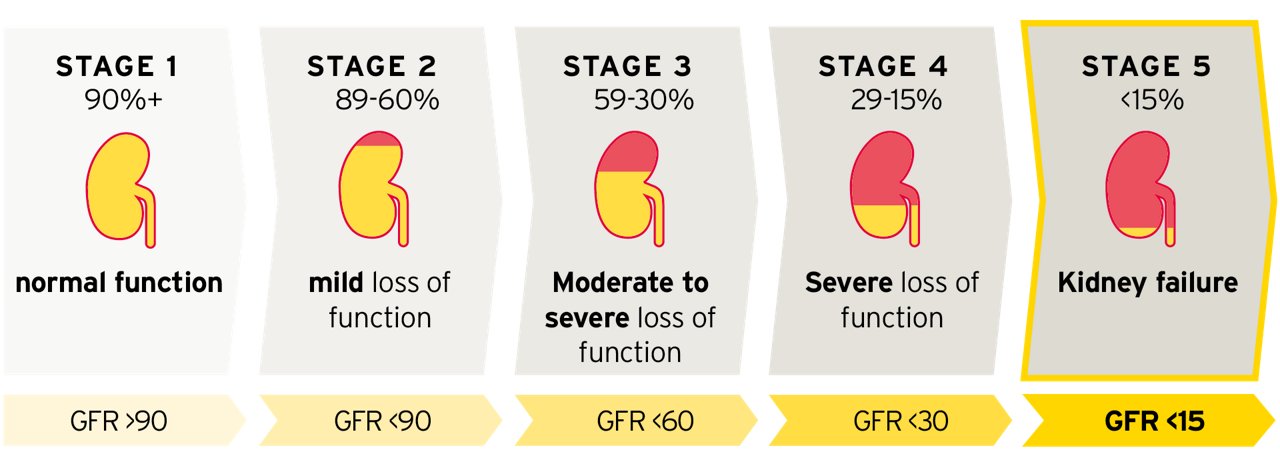 Stages of CKD and corresponding GFR values