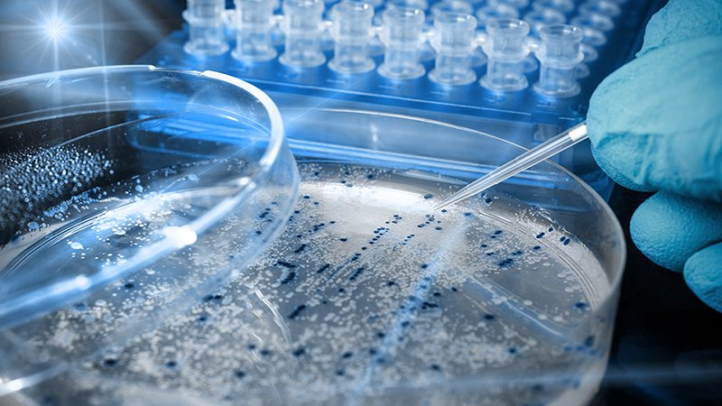 Gloved hand uses pipette to transfer liquid into petri dish with blue dots; lab tools in background.